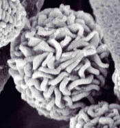 Stachybotrys spore 40,000x.  